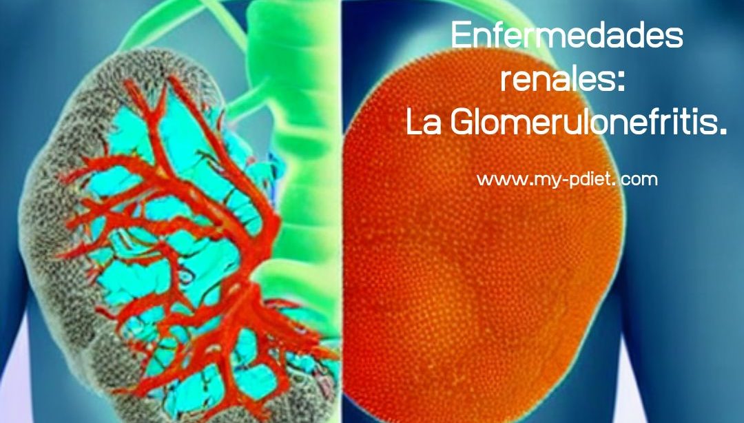 Enfermedades renales: La Glomerulonefritis., nutricionista