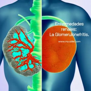 Enfermedades renales: La Glomerulonefritis., nutricionista