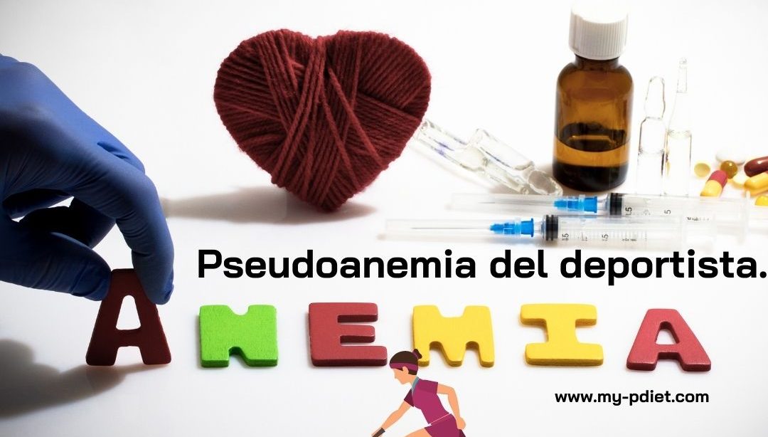 Pseudoanemia del deportista. nutricionista, nutricionista clínica