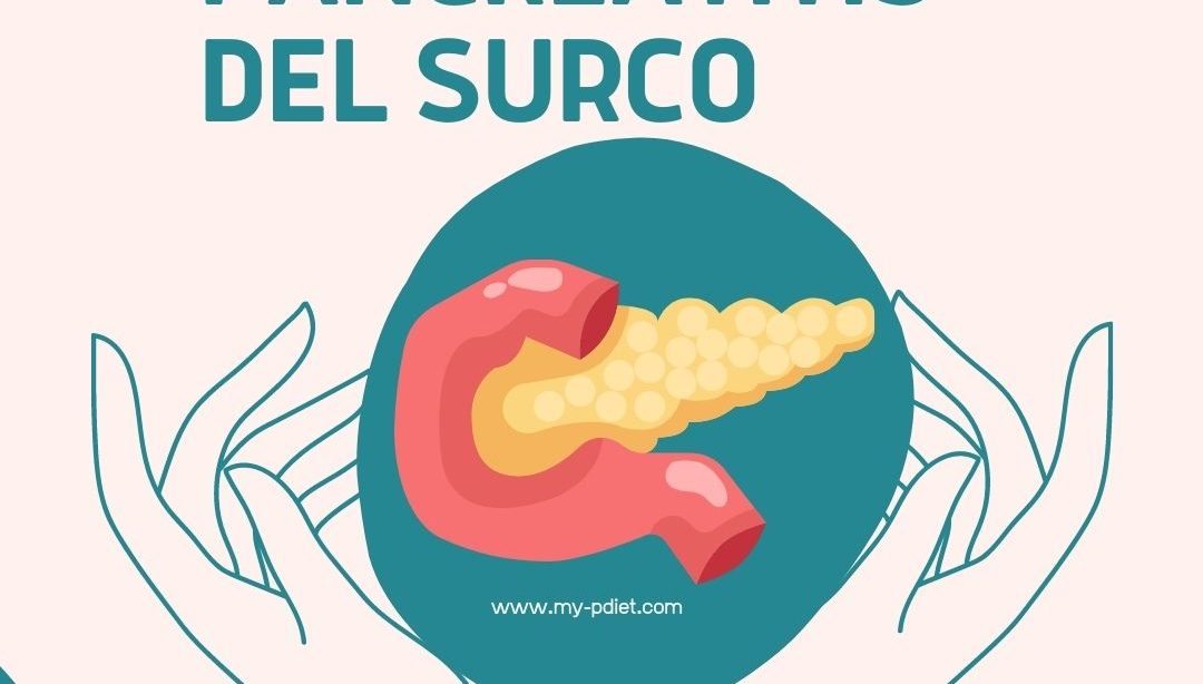 Pancreatitis del surco, nutrición, nutricionista cliínica
