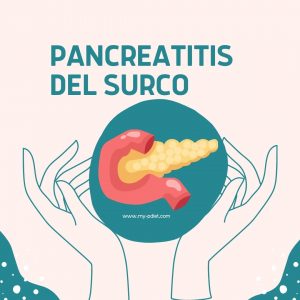Pancreatitis del surco, nutrición, nutricionista cliínica
