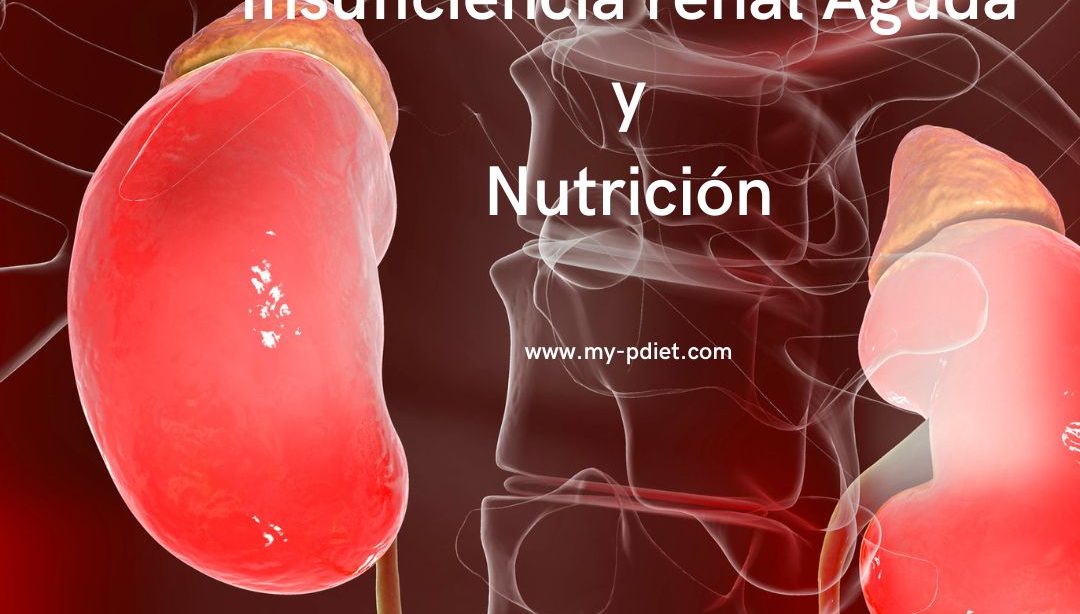 Insuficiencia renal Aguda y Nutrición, nutricionista, nutricionista clínica