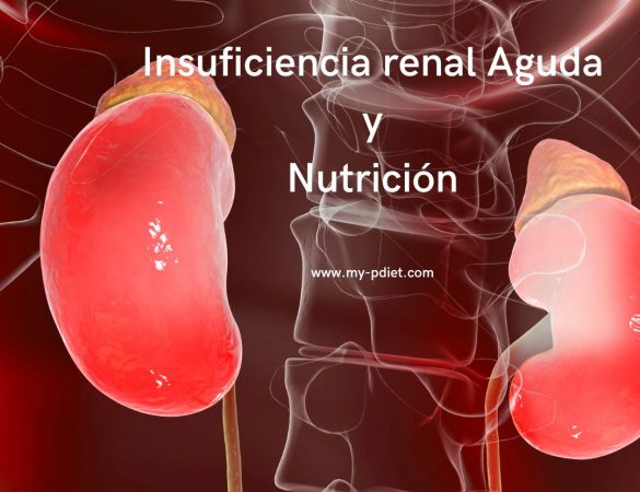 Insuficiencia renal Aguda y Nutrición, nutricionista, nutricionista clínica