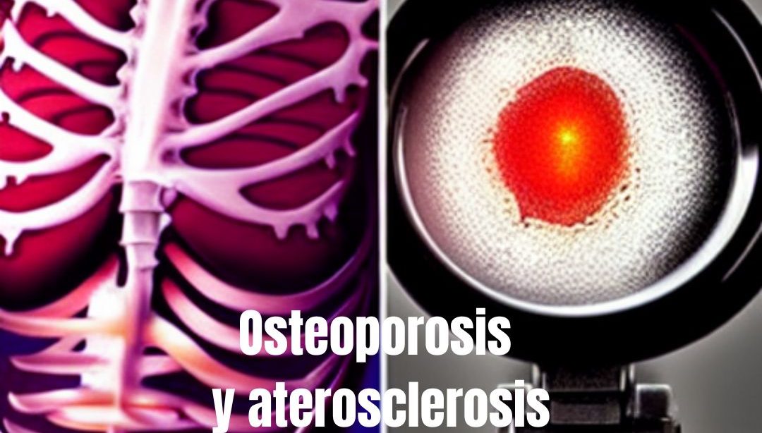 Osteoporosis y aterosclerosis, nutricionista, nutricionista clínica