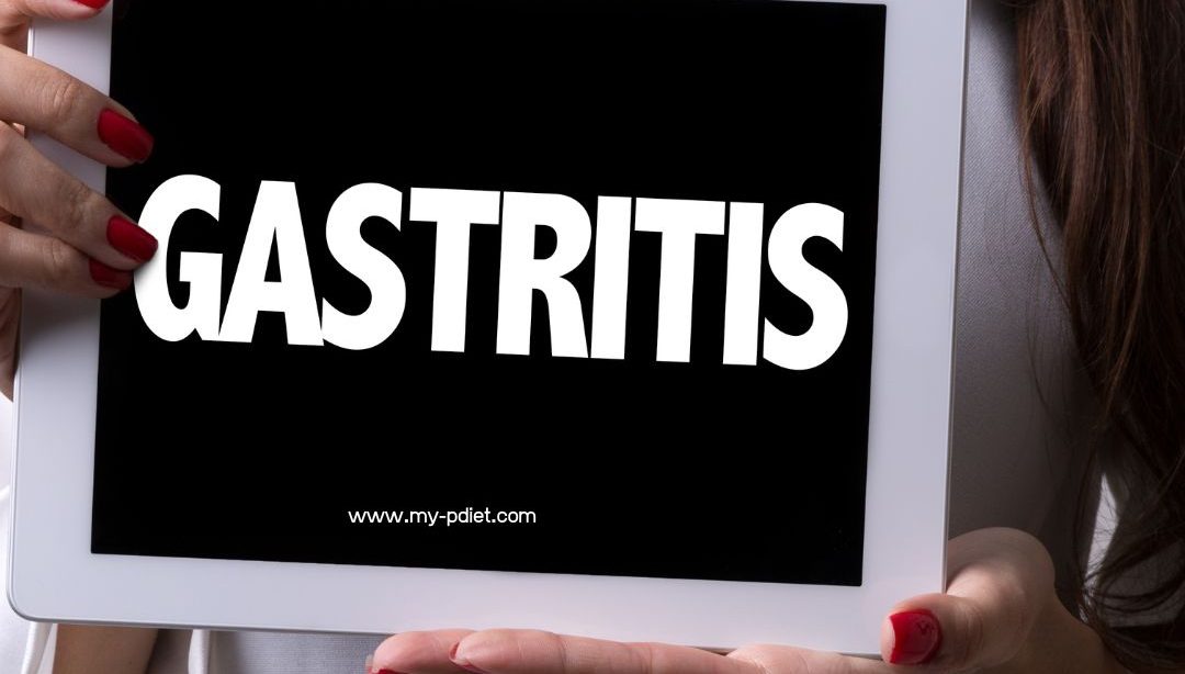 Manejo de la gastritis: recomendaciones nutricionales, nutricionista clínica, salud digestiva